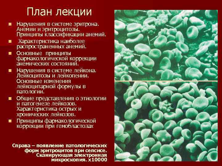 План лекции n n n Нарушения в системе эритрона. Анемии и эритроцитозы. Принципы классификации