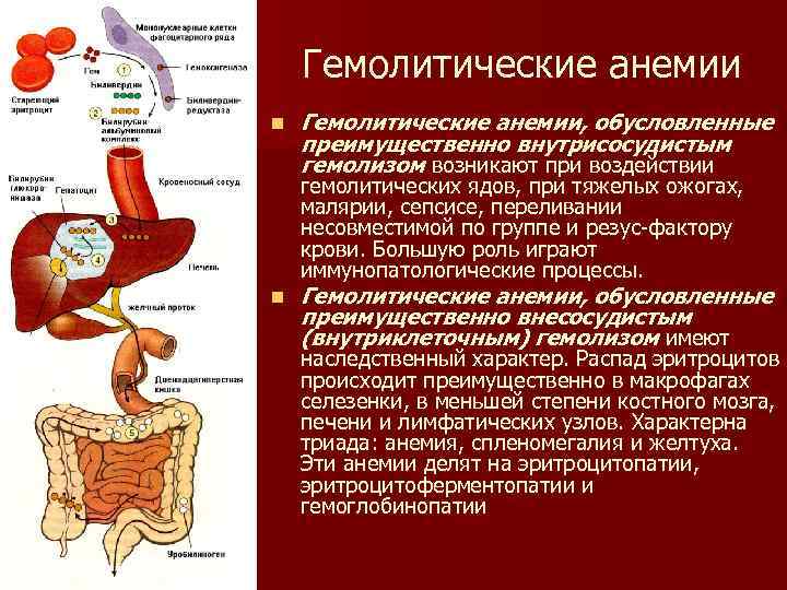 Гемолитические анемии n Гемолитические анемии, обусловленные преимущественно внутрисосудистым гемолизом возникают при воздействии гемолитических ядов,