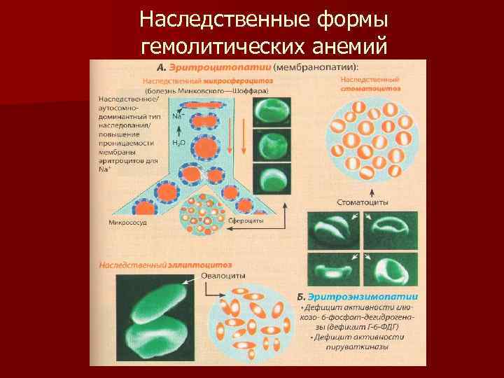 Наследственные формы гемолитических анемий 