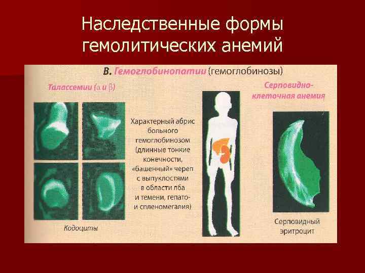 Наследственные формы гемолитических анемий 