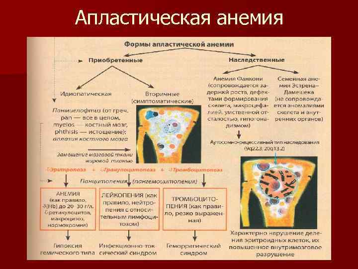 Апластическая анемия 