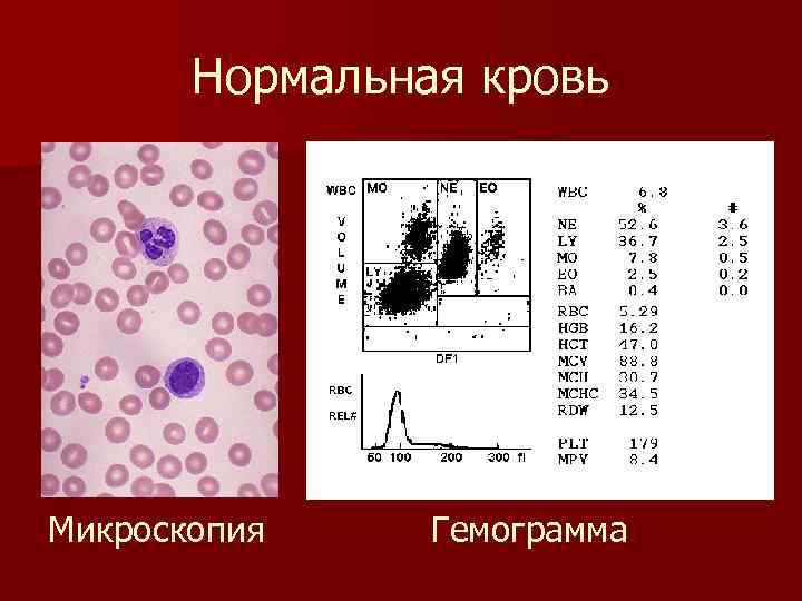 Нормальная кровь Микроскопия Гемограмма 