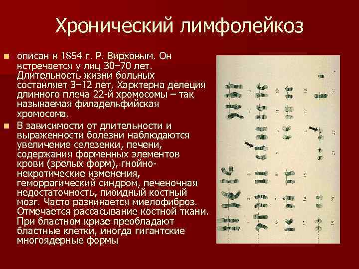 Хронический лимфолейкоз описан в 1854 г. Р. Вирховым. Он встречается у лиц 30– 70