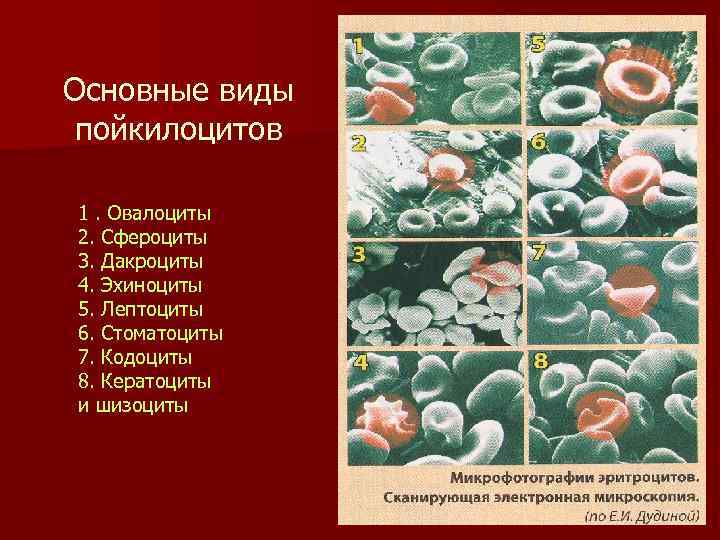 Основные виды пойкилоцитов 1. Овалоциты 2. Сфероциты 3. Дакроциты 4. Эхиноциты 5. Лептоциты 6.