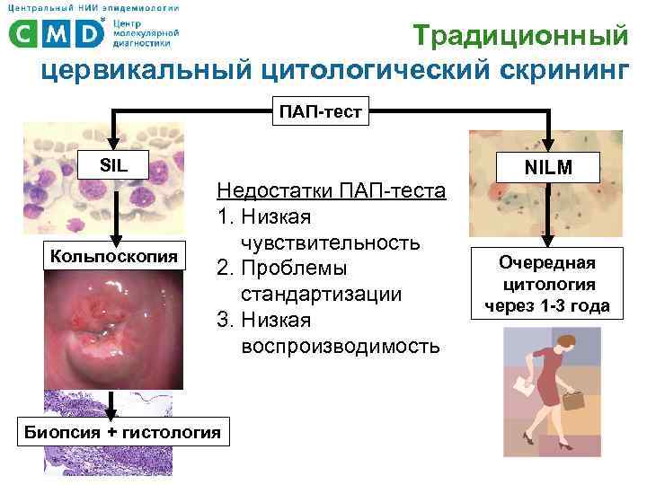 Традиционный цервикальный цитологический скрининг ПАП-тест SIL Кольпоскопия Недостатки ПАП-теста 1. Низкая чувствительность 2. Проблемы