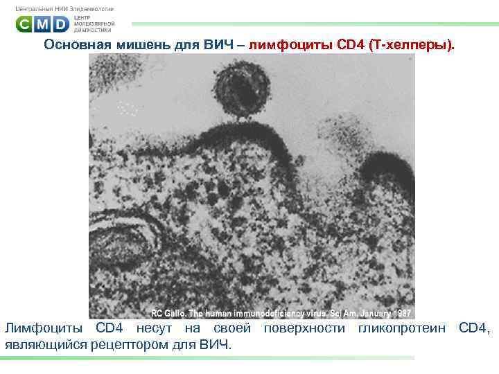 Основная мишень для ВИЧ – лимфоциты CD 4 (T-хелперы). Лимфоциты CD 4 несут на