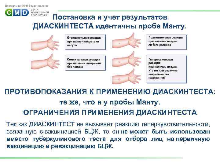 Постановка и учет результатов ДИАСКИНТЕСТА идентичны пробе Манту. ПРОТИВОПОКАЗАНИЯ К ПРИМЕНЕНИЮ ДИАСКИНТЕСТА: те же,