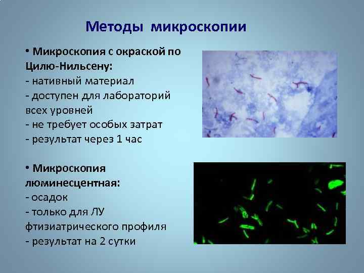 Методы микроскопии • Микроскопия с окраской по Цилю-Нильсену: - нативный материал - доступен для