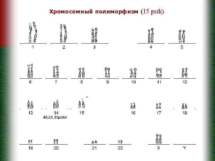 Хромосомный полиморфизм (15 pstk) 