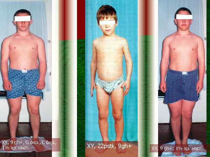 XY, 9 gh+, G окр. , С окр. , 1% хр. нест. XY, 22