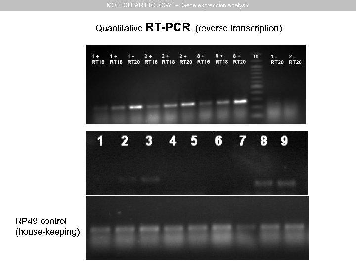 MOLECULAR BIOLOGY – Gene expression analysis Quantitative RT-PCR (reverse transcription) RP 49 control (house-keeping)