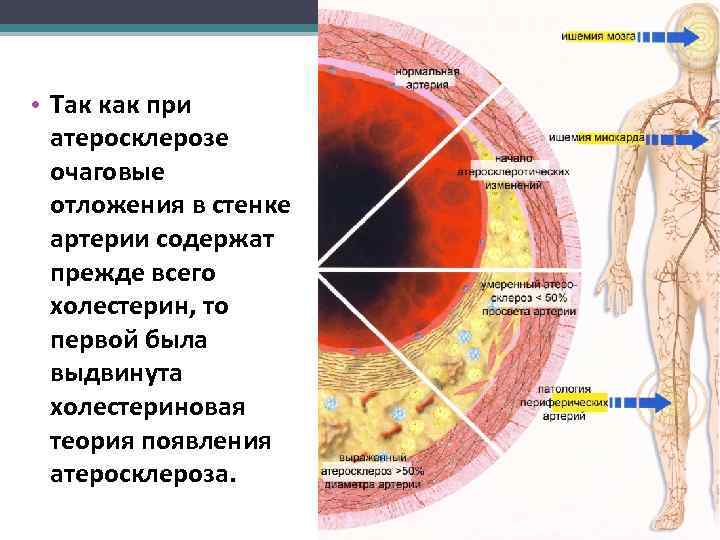  • Так как при атеросклерозе очаговые отложения в стенке артерии содержат прежде всего