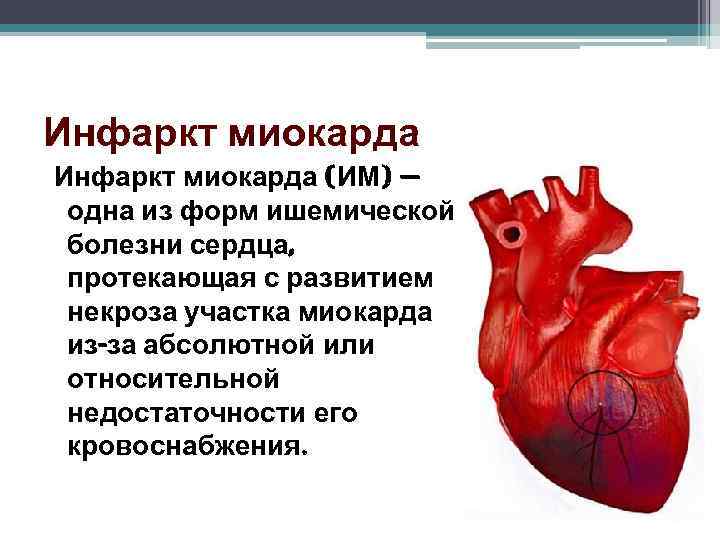 Инфаркт миокарда (ИМ) — одна из форм ишемической болезни сердца, протекающая с развитием некроза