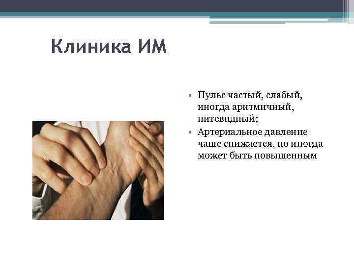 Клиника ИМ • Пульс частый, слабый, иногда аритмичный, нитевидный; • Артериальное давление чаще снижается,