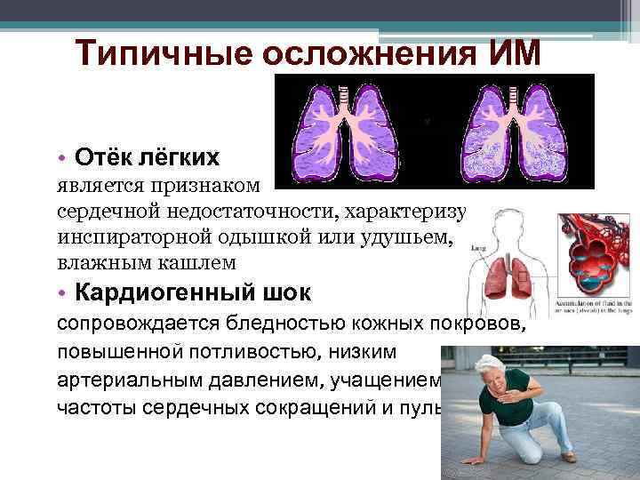 Типичные осложнения ИМ • Отёк лёгких является признаком сердечной недостаточности, характеризуется инспираторной одышкой или