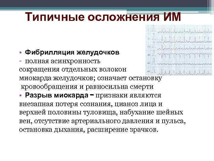Типичные осложнения ИМ • Фибрилляция желудочков - полная асинхронность сокращения отдельных волокон миокарда желудочков;