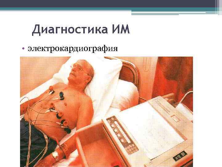 Диагностика ИМ • электрокардиография 