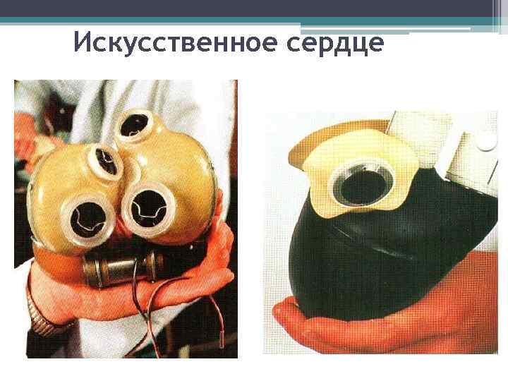 Искусственное сердце 