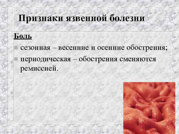 Признаки язвенной болезни Боль n сезонная – весенние и осенние обострения; n периодическая –