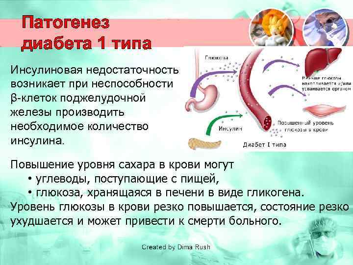 Патогенез диабета 1 типа Инсулиновая недостаточность возникает при неспособности β-клеток поджелудочной железы производить необходимое