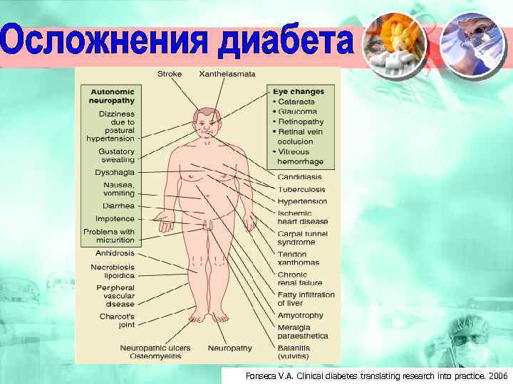 Fonseca V. A. Clinical diabetes translating research into practice. 2006 