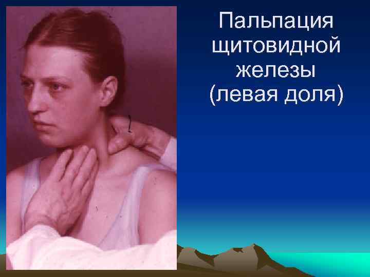 Пальпация щитовидной железы (левая доля) 