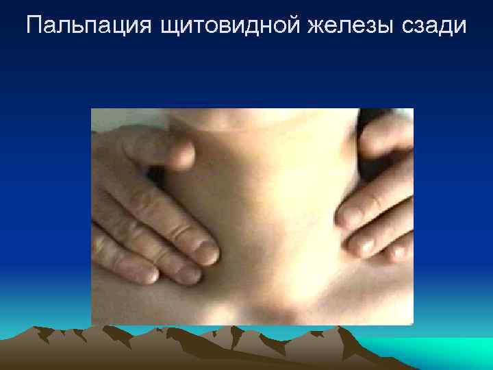 Пальпация щитовидной железы сзади 