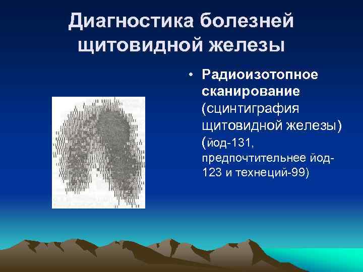 Диагностика болезней щитовидной железы • Радиоизотопное сканирование (сцинтиграфия щитовидной железы) (йод-131, предпочтительнее йод 123
