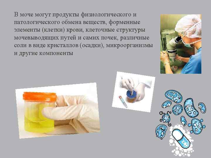 В моче могут продукты физиологического и патологического обмена веществ, форменные элементы (клетки) крови, клеточные