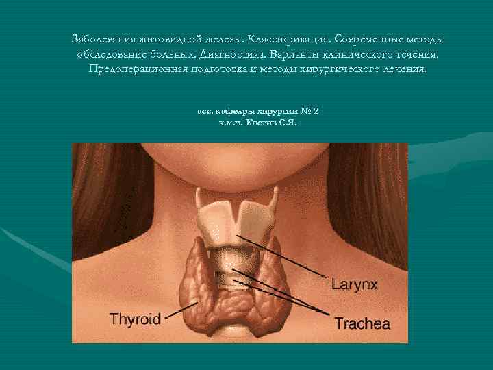 Заболевания житовидной железы. Классификация. Современные методы обследование больных. Диагностика. Варианты клинического течения. Предоперационная подготовка
