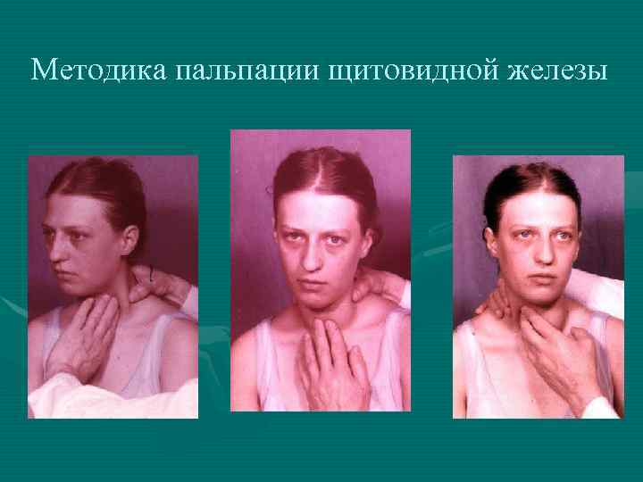 Методика пальпации щитовидной железы 