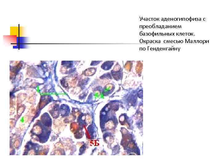 Участок аденогипофиза с преобладанием базофильных клеток. Окраска смесью Маллори по Генденгайну 