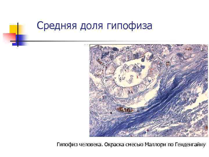 Средняя доля гипофиза Гипофиз человека. Окраска смесью Маллори по Генденгайну 