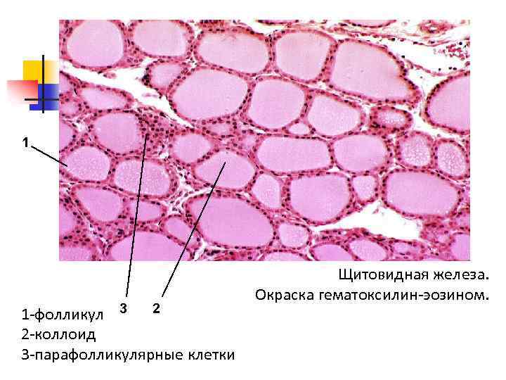 1 1 -фолликул 3 2 2 -коллоид 3 -парафолликулярные клетки Щитовидная железа. Окраска гематоксилин-эозином.