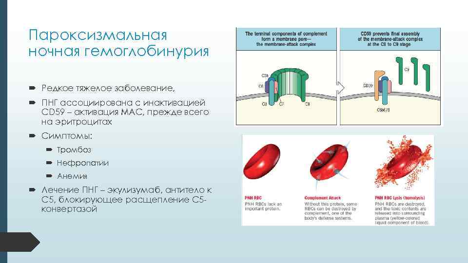 Пароксизмальная ночная гемоглобинурия Редкое тяжелое заболевание, ПНГ ассоциирована с инактивацией CD 59 – активация