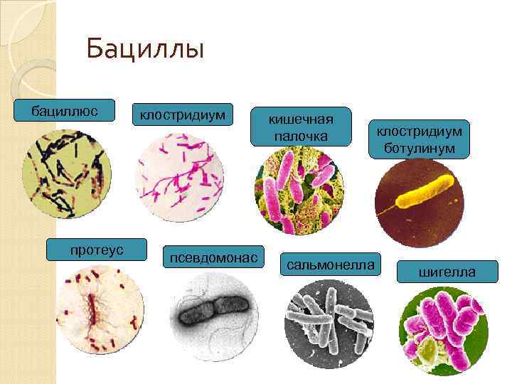 Бациллы бациллюс протеус клостридиум псевдомонас кишечная палочка сальмонелла клостридиум ботулинум шигелла 