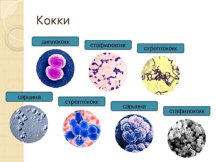 Кокки диплококк сарцина стафилококк стрептококк сарцина стафилококк 