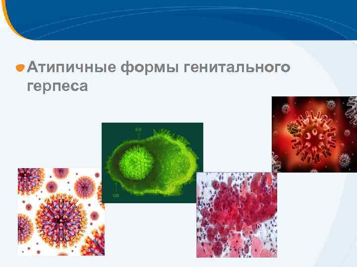 Атипичные формы генитального герпеса 