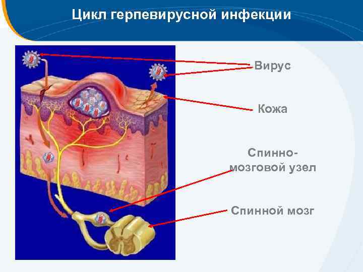Цикл герпевирусной инфекции Вирус Кожа Спинномозговой узел Спинной мозг 