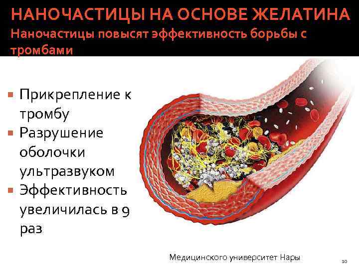 НАНОЧАСТИЦЫ НА ОСНОВЕ ЖЕЛАТИНА Наночастицы повысят эффективность борьбы с тромбами Прикрепление к тромбу Разрушение