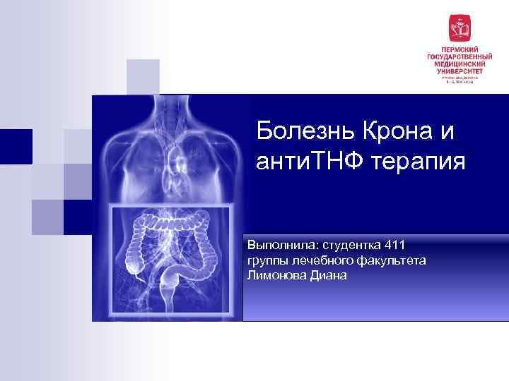 Болезнь Крона и анти. ТНФ терапия Выполнила: студентка 411 группы лечебного факультета Лимонова Диана