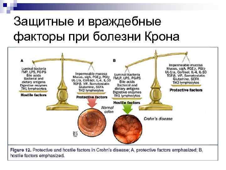 Защитные и враждебные факторы при болезни Крона 