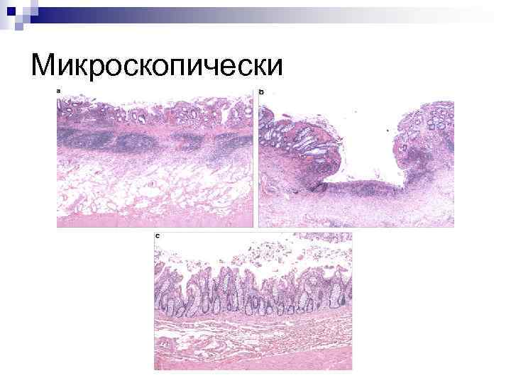 Микроскопически 