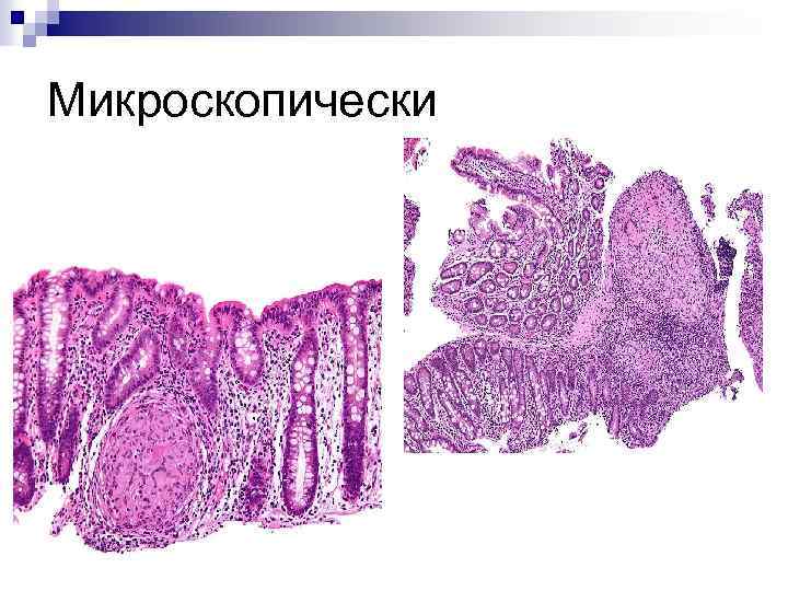 Микроскопически 