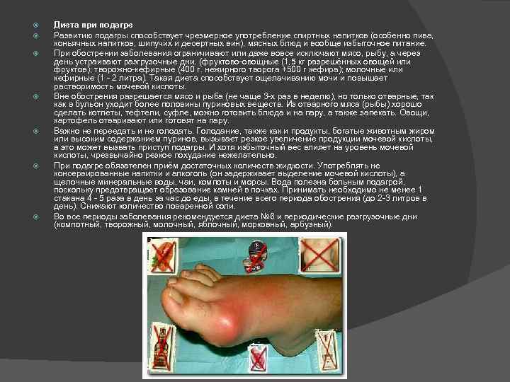  Диета при подагре Развитию подагры способствует чрезмерное употребление спиртных напитков (особенно пива, коньячных