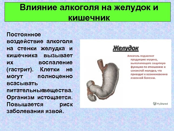 Влияние алкоголя на желудок и кишечник Постоянное воздействие алкоголя на стенки желудка и кишечника
