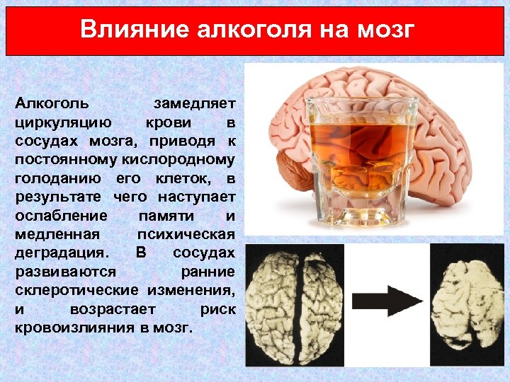 Как понять пьющего человека. Влияние алкоголизма на головной мозг.