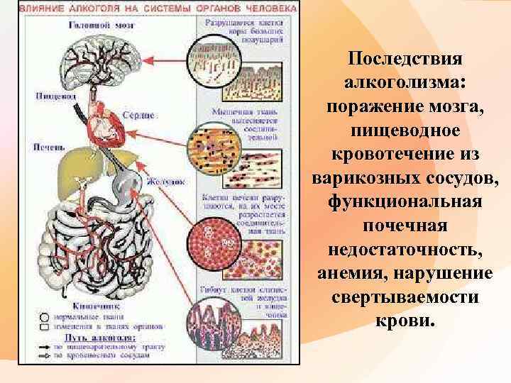 Последствия алкоголизма: поражение мозга, пищеводное кровотечение из варикозных сосудов, функциональная почечная недостаточность, анемия, нарушение