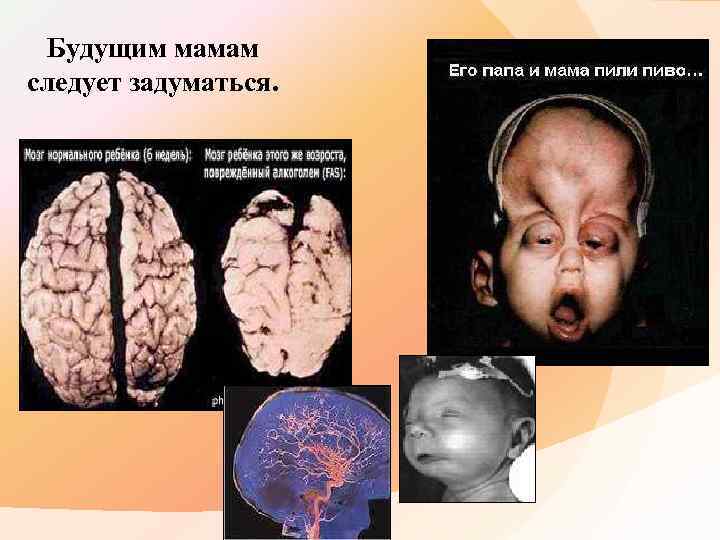 Будущим мамам следует задуматься. 