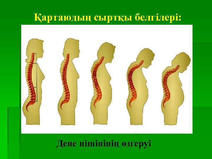 Қартаюдың сыртқы белгілері: Дене пішінінің өзгеруі 